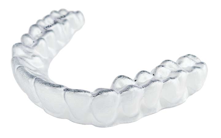 Ortodontia Alinhadores Transparentes