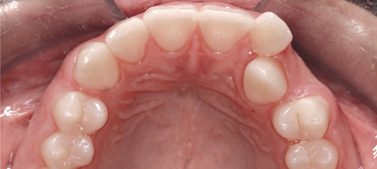 Ortodontia - Antes e Depois