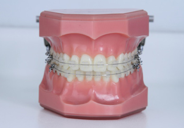 Ortodontia em Sintra